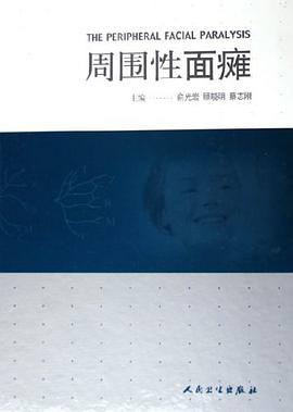 周圍性面癱 周圍性面癱