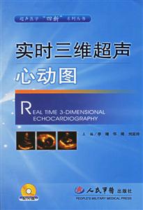 實時三維超聲心動圖 實時三維超聲心動圖